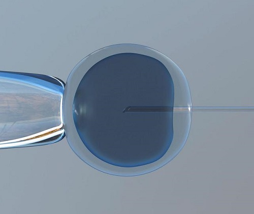 2021有胚胎第二次試管嬰兒流程怎樣的？