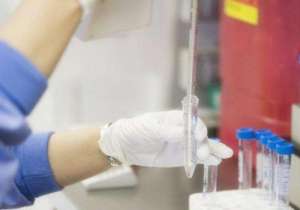 國內做試管的費用一般是多少