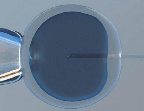 美國和泰國試管嬰兒哪個好