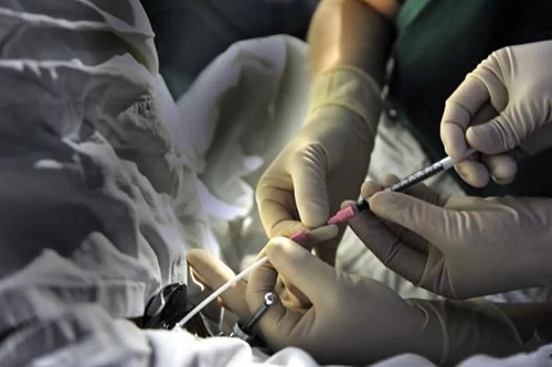 如何選擇比較好的試管醫院呢