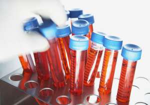 生子做第三代試管的費用