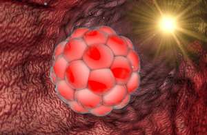 泰國做試管的價格問題