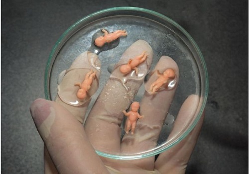 試管嬰兒醫院排行榜有何標準