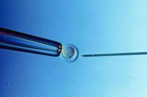 美國試管嬰兒醫院特點是什么