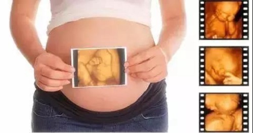 美國試管嬰兒優勢是什么