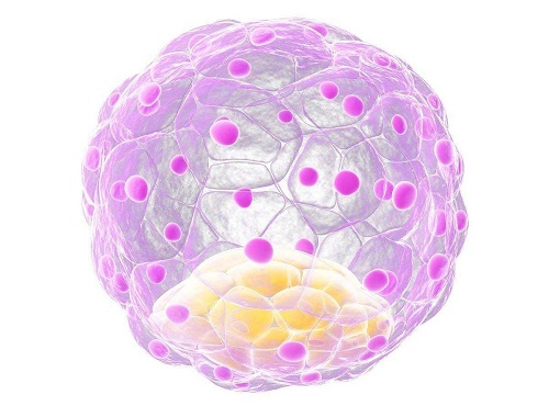 泰國試管嬰兒費用大約多少錢