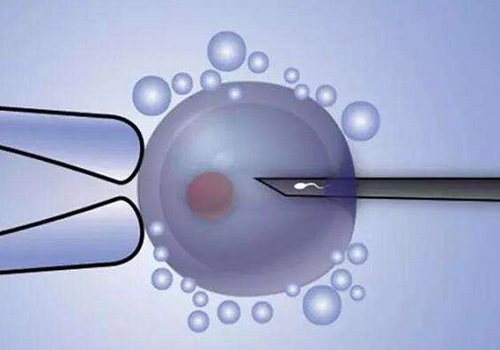 選擇俄羅斯試管嬰兒方向中介機構的方法