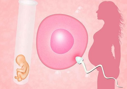 做俄羅斯試管嬰兒有什么優勢
